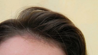 Como cuidar do couro cabeludo?